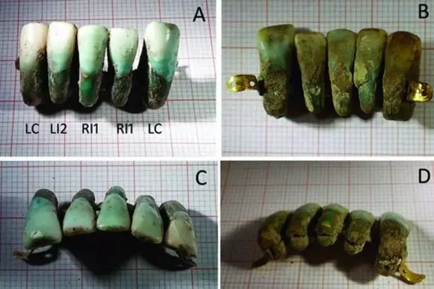 10 činjenica o stomatologiji prošlosti, nakon čega će se prestati bojati stomatologa 35529_2