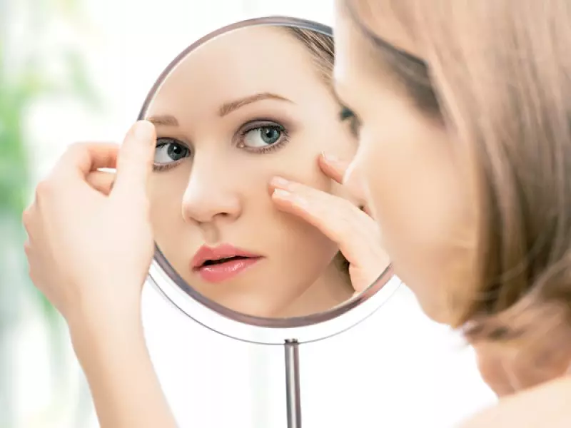 Na loita pola beleza: tire 7 mitos comúns sobre o acne 40776_2